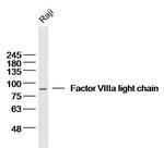 Factor 8a light chain Antibody in Western Blot (WB)