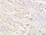 MEK1/2 Antibody in Immunohistochemistry (Paraffin) (IHC (P))