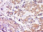 MEK1/2 Antibody in Immunohistochemistry (Paraffin) (IHC (P))