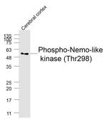 Phospho-Nemo-like kinase (Thr298) Antibody in Western Blot (WB)