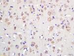 TSPAN12 Antibody in Immunohistochemistry (Paraffin) (IHC (P))