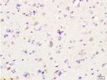 MIF Antibody in Immunohistochemistry (Paraffin) (IHC (P))