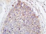 TLR2 Antibody in Immunohistochemistry (Paraffin) (IHC (P))