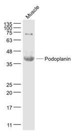 Podoplanin Antibody in Western Blot (WB)