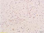 CHRNA7 Antibody in Immunohistochemistry (Paraffin) (IHC (P))