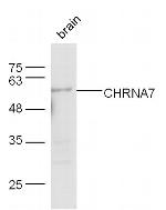 CHRNA7 Antibody in Western Blot (WB)