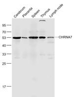 CHRNA7 Antibody in Western Blot (WB)