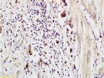 CCP Antibody in Immunohistochemistry (Paraffin) (IHC (P))
