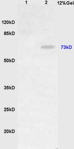 HDC Antibody in Western Blot (WB)