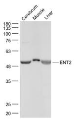 ENT2 Antibody in Western Blot (WB)