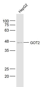 GOT2 Antibody in Western Blot (WB)