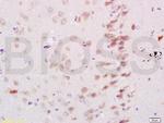 Neurocan Antibody in Immunohistochemistry (Paraffin) (IHC (P))