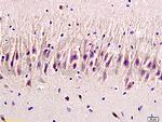 5-HTR2 Antibody in Immunohistochemistry (Paraffin) (IHC (P))