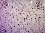 5-HTR2 Antibody in Immunohistochemistry (Paraffin) (IHC (P))