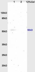 5-HTR2 Antibody in Western Blot (WB)