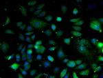 Integrin Alpha 3 + Beta 1 Antibody in Immunocytochemistry (ICC/IF)