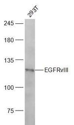 EGFRvIII Antibody in Western Blot (WB)