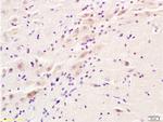 ADRA2 Antibody in Immunohistochemistry (Paraffin) (IHC (P))
