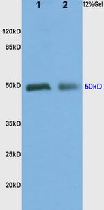 ADRA2 Antibody in Immunohistochemistry (Paraffin) (IHC (P))