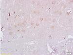 beta 3 Adrenergic Receptor Antibody in Immunohistochemistry (Paraffin) (IHC (P))