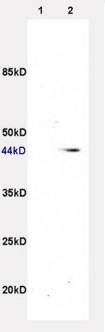 beta 3 Adrenergic Receptor Antibody in Western Blot (WB)