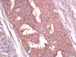 Troponin T Antibody in Immunohistochemistry (Paraffin) (IHC (P))