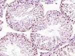 SCP3 Antibody in Immunohistochemistry (Paraffin) (IHC (P))
