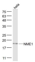 NME1 Antibody in Western Blot (WB)