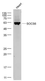 SOCS6 Antibody in Western Blot (WB)