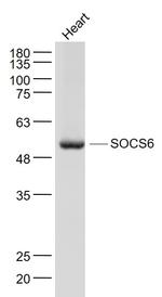SOCS6 Antibody in Western Blot (WB)
