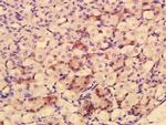 HRAS Antibody in Immunohistochemistry (Paraffin) (IHC (P))