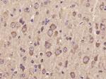 AKT2 Antibody in Immunohistochemistry (Paraffin) (IHC (P))