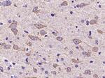 AKT2 Antibody in Immunohistochemistry (Paraffin) (IHC (P))