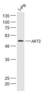 AKT2 Antibody in Western Blot (WB)