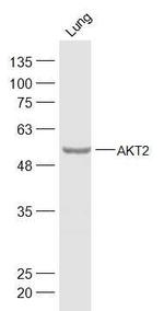 AKT2 Antibody in Western Blot (WB)