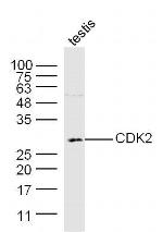 CDK2 Antibody in Western Blot (WB)