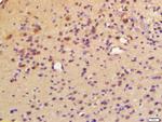 LPCAT2 Antibody in Immunohistochemistry (Paraffin) (IHC (P))