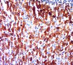 Secretogranin-5 Antibody in Immunohistochemistry (Paraffin) (IHC (P))
