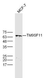TM9SF1 Antibody in Western Blot (WB)