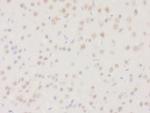 DHRS2 Antibody in Immunohistochemistry (Paraffin) (IHC (P))