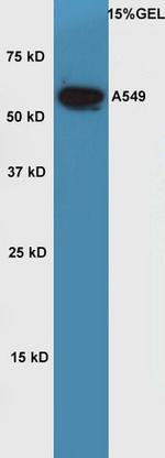 OCT2 Antibody in Western Blot (WB)