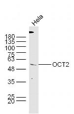 OCT2 Antibody in Western Blot (WB)
