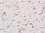 NADPH oxidase 4 Antibody in Immunohistochemistry (Paraffin) (IHC (P))