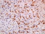 ADRB3 Antibody in Immunohistochemistry (Paraffin) (IHC (P))