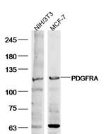 PDGFRA Antibody in Western Blot (WB)