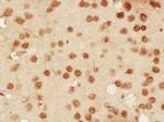 DNA PKcs Antibody in Immunohistochemistry (Paraffin) (IHC (P))