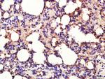 Calpain 1 Antibody in Immunohistochemistry (Paraffin) (IHC (P))