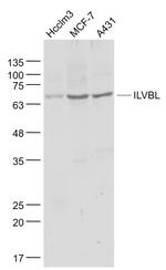 ILVBL Antibody in Western Blot (WB)