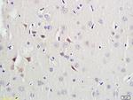 PAX9 Antibody in Immunohistochemistry (Paraffin) (IHC (P))