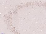 Gliomedin Antibody in Immunohistochemistry (Paraffin) (IHC (P))